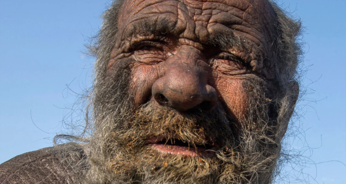 The World’s ‘Dirtiest’ Man Did Not Shower For Over 60 Years – His Reason Is Shocking