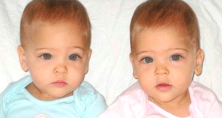 They were named the world’s most attractive twins when they were babies! Here is how they look now