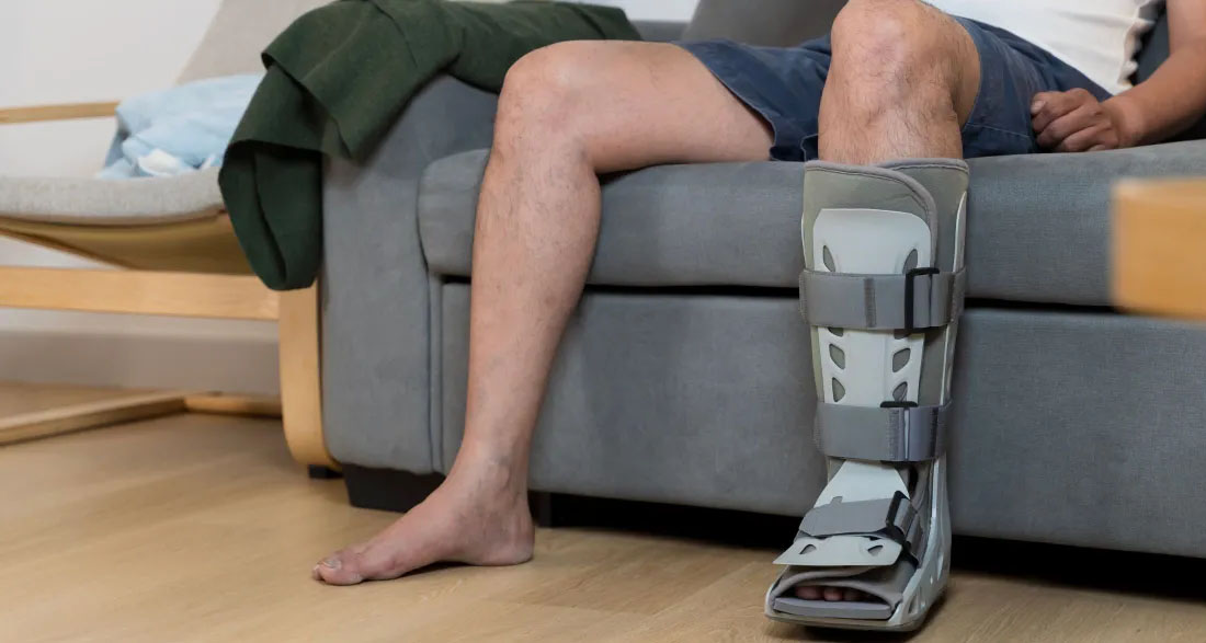 My Husband Showed Up with a Cast on His Leg the Day Before Our First Family Vacation – Then I Got a Call That Changed Everything