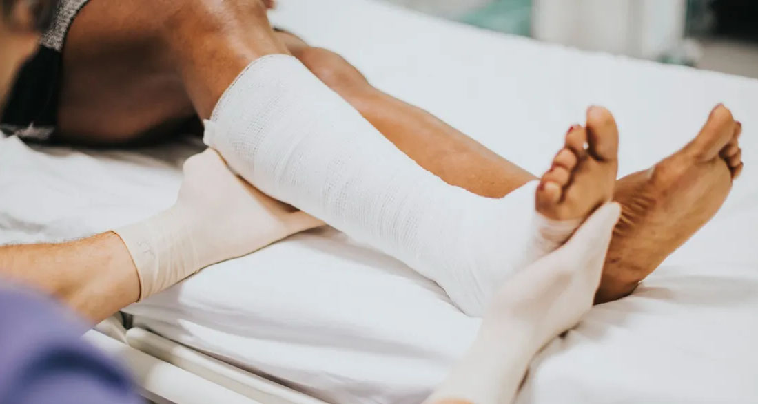 I Broke My Arm and Leg Before My Dad Married My Mom’s Sister – They Still Made Me Plan the Wedding… So Grandma Showed Up and Dropped a ‘Gift’ That Made Them Scream